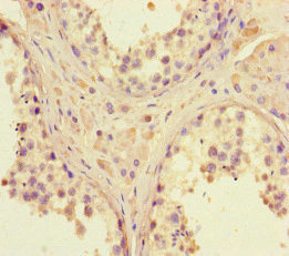 CSB-PA883358HA01HU