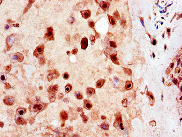 CSB-PA883400LA01HU