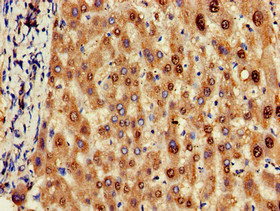 CSB-PA885708LA01HU