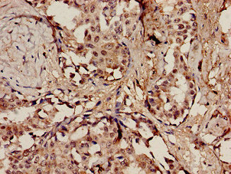 CSB-PA894382LA01HU