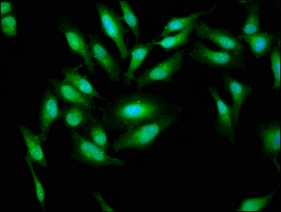 CSB-PA001023LA01HU