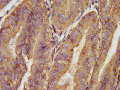 CSB-PA001023LA01HU