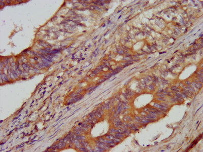 CSB-PA001023LA01HU