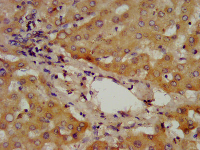 CSB-PA001301LA01HU
