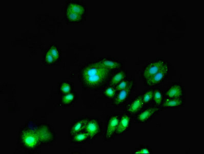 CSB-PA007083LA01HU