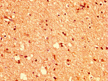 CSB-PA007722LA01HU