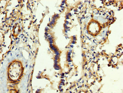 CSB-PA008608LA01HU