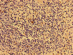 CSB-PA011651EA01HU
