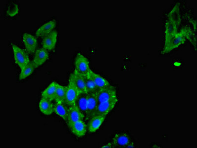 CSB-PA012721LA01HU