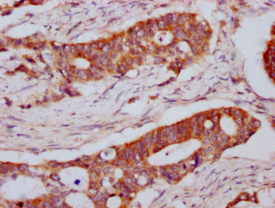 CSB-PA013065LA01HU