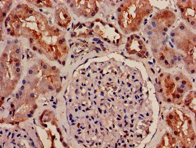 CSB-PA016331LA01HU