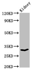 CSB-PA016331LA01HU