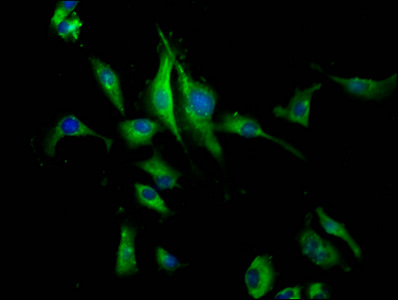 CSB-PA017765LA01HU