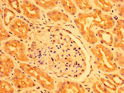 CSB-PA017765LA01HU