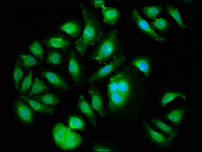 CSB-PA018193LA01HU