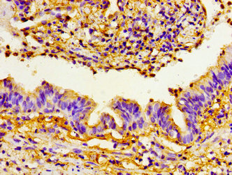 CSB-PA018830LA01HU