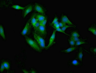 CSB-PA022392EA01HU