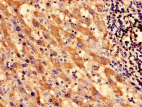 CSB-PA022392EA01HU