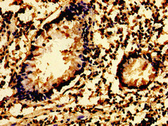 CSB-PA022998LA01HU