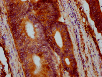 CSB-PA029544EA01HU
