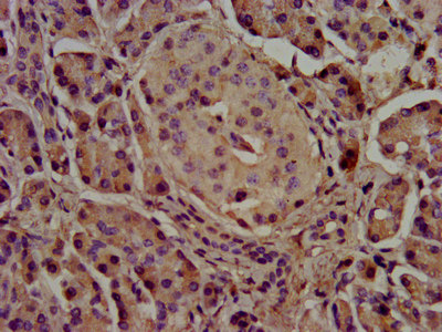 CSB-PA325708LA01HU