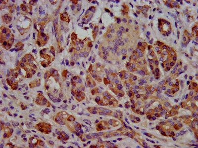 CSB-PA325708LA01HU