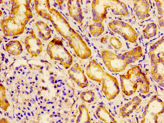 CSB-PA341920LA01HU