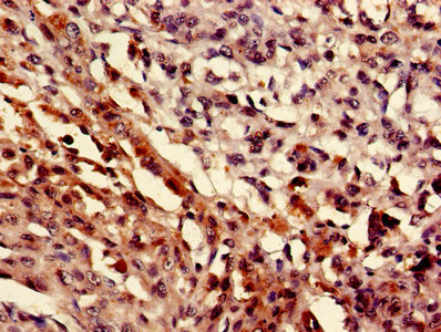 CSB-PA613522LA01HU