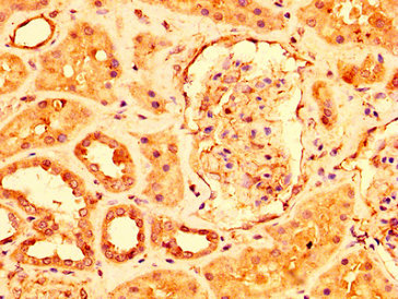 CSB-PA614393LA01HU