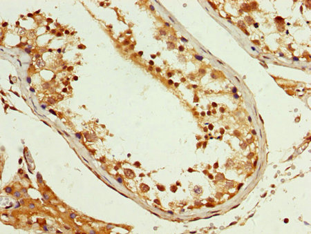 CSB-PA622995LA01HU