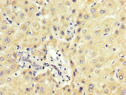 CSB-PA622995LA01HU