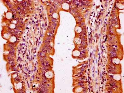 CSB-PA731656LA01HU