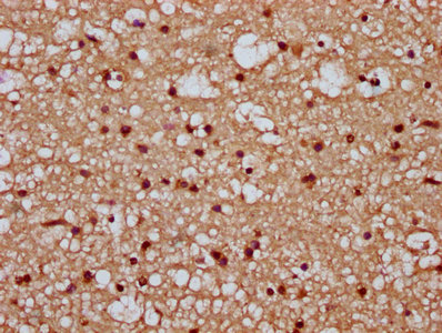 CSB-PA801800LA01HU