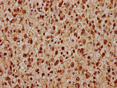 CSB-PA801800LA01HU