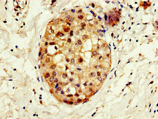 CSB-PA838805LA01HU