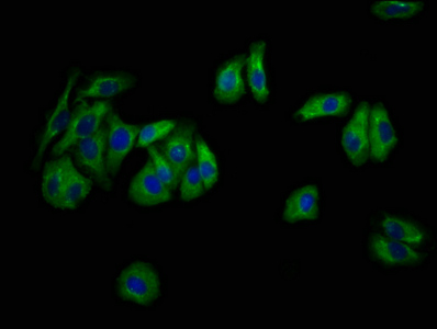 CSB-PA848831LA01HU
