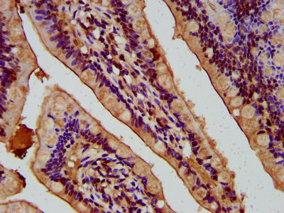 CSB-PA848831LA01HU