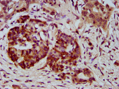 CSB-PA848831LA01HU