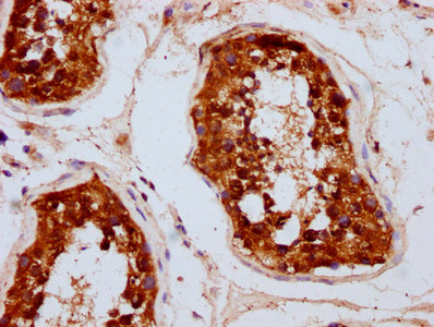 CSB-PA854093LA01HU