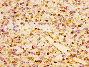 CSB-PA856406LA01HU
