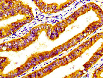 CSB-PA859102LA01HU