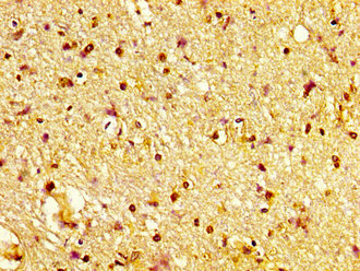 CSB-PA859102LA01HU
