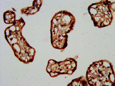 CSB-EP017315HUb3 IHC-2