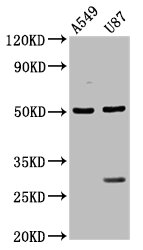 CSB-PA865129LA01HU