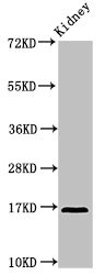 CSB-PA866201HA01HU