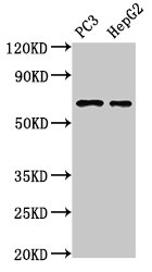 CSB-PA866224LA01HU