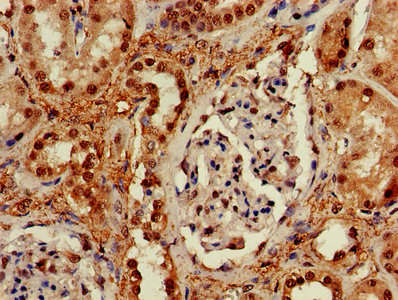 CSB-PA897459LA01HU