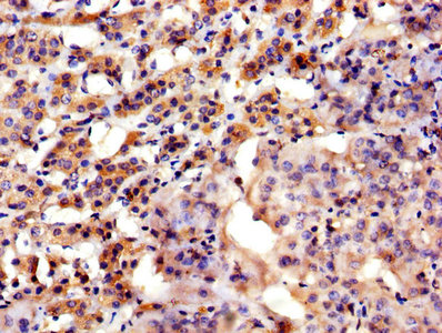CSB-PA002226HA01HU