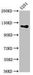 CSB-PA010054LA01HU