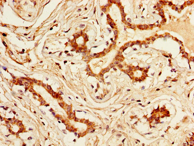 CSB-PA012446LA01HU
